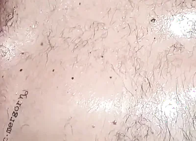 Stillness and Skin
