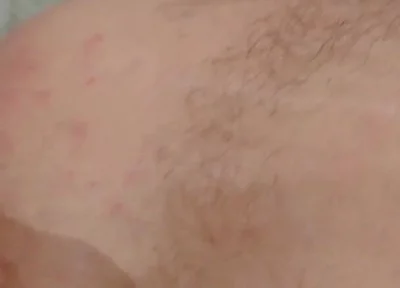Masturbation