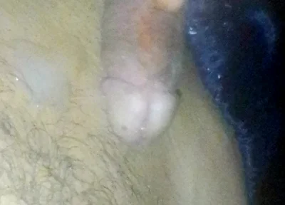 Boy Roasts His Straw and Smears It All Over His Stomach at Night While His Parents Are Away