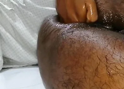 තම පකට තම අතමය පටටම ෆසටන එකක කර වදනව Extreme Self Fisting Best One Ever Huge Cum Load