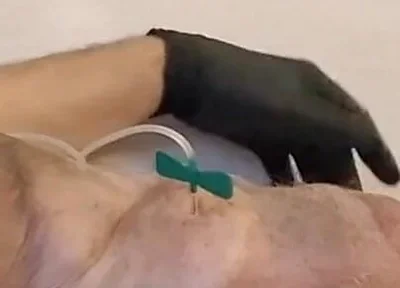 What a Big Obscene Package of Silicone Meat