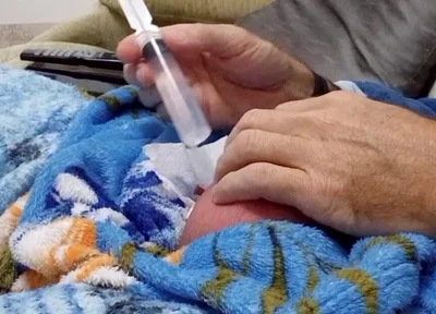 60cc Saline Injection in Each Egg