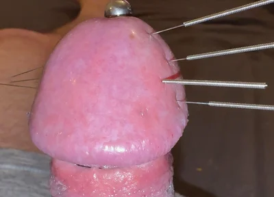 Needles Through the Thick, Hard Glans, Mega Orgasm