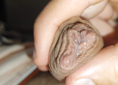 Silent Purge of Straight Scrotal Fluid.