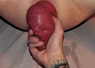 Arty Boer and Prolapsiboy.