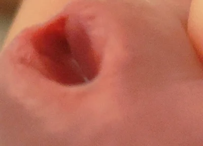 Amazing Closeup of the Widened Hole!!