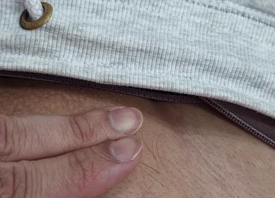 The Hair on My Penis - Led Hair Removal