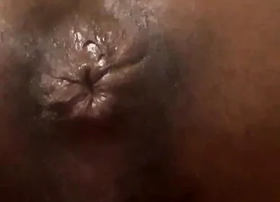 Talking About My Butt Hole