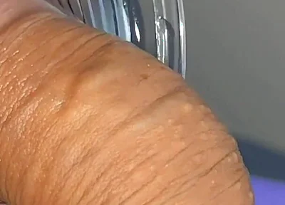 Mysterious Solution Inserted Into the Wrinkled Cock.