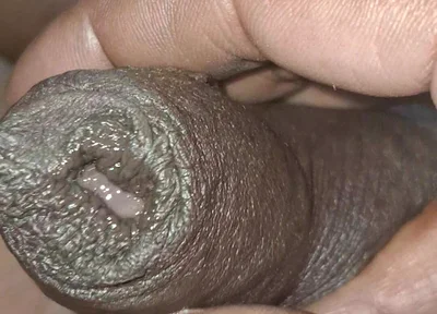 Playing with My Penis