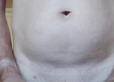 Dilatator