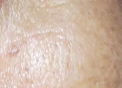 Milk Bath