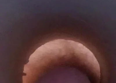 Tunnel Vision