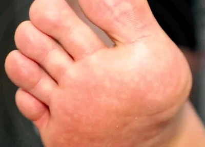 Golden Foot Bath for Pigs