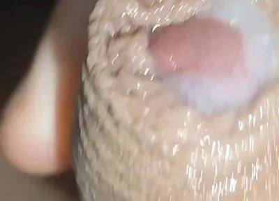 I Have the Largest Ejaculating Phimosis in the World!!
