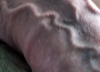 Throbbing