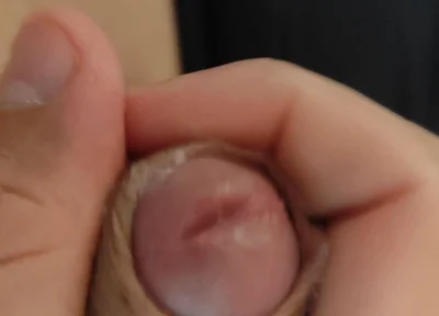 Amazing Pre Cum Glans.