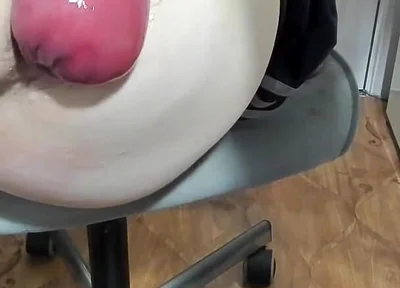 A Piece of Intestine Hangs From a Young Ass