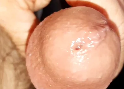 Masturbation