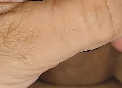 Electrical Pulsation Within the Glans with Rapid Excitation.