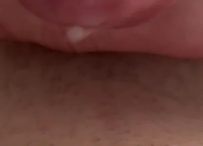 Sperm