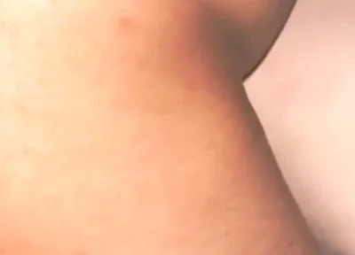 Smooth Skin