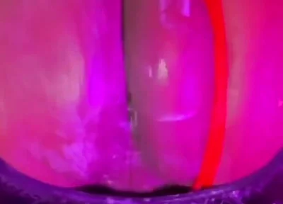 Why Yo Butt so Big?