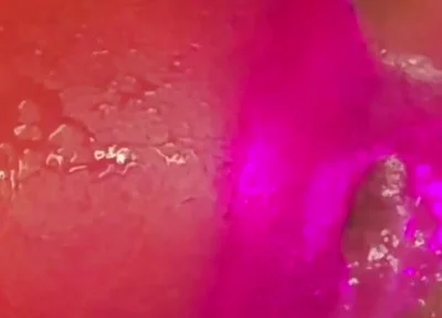 What a Blow Hole
