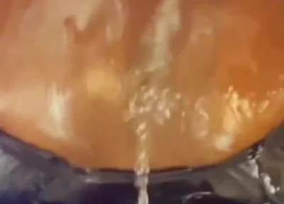Creampie Ejector