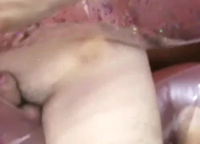 Inflatable lips