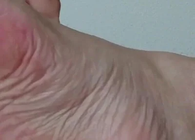 My Ugly Bare Feet in Bed