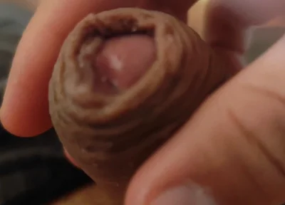 Great Phimosis Getting in the Way of the Boy's Orgasm