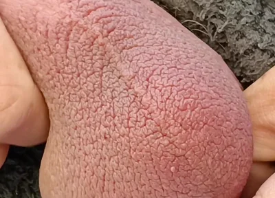 Big Uncut Cock Edging and Cumming, Outdoor Onesie Wank for the Neighbours - Rockardglans