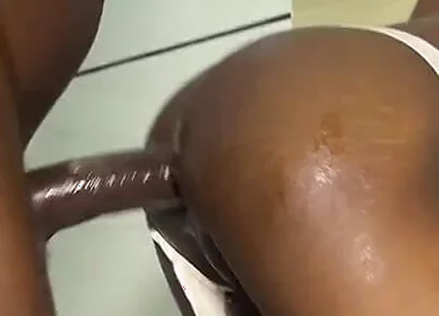 He Damaged His Ass Hole