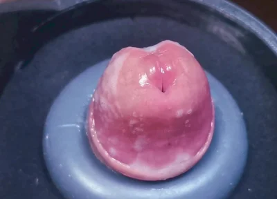 Penis Machine with a New Attachment