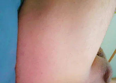 Widening the Ass Opening for Easy Orgasm.