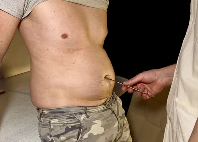 Swollen Perfection - Private Check-up