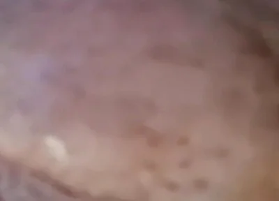 Extreme Fillings Inside My Siliconemeat