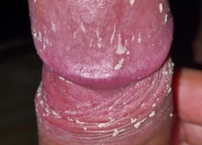 Checking My Dirty Dick