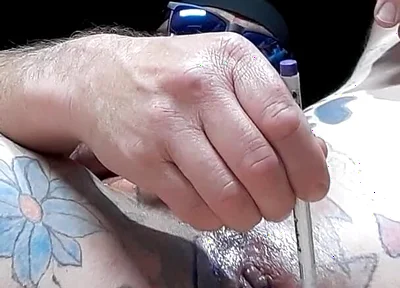 My Butt Hole Has Been Swollen Like This for 2 Days