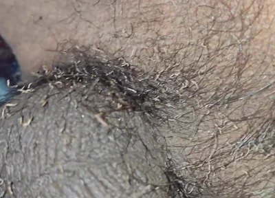 My Bushes Catch Fire Burning Penis Shaved Penis by Fire