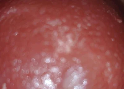 Deep Thrusts Trigger Feverish Cum Inside Without Sperm's Trace