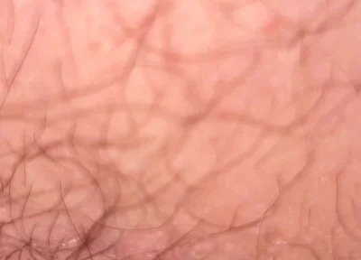Close up Hairy Hole