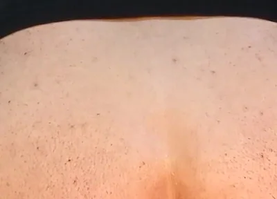 He Enjoys Sucking on His Anal Prolapse