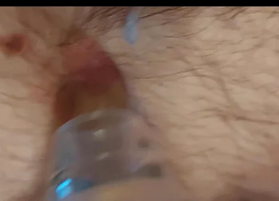A Close-up Shot of My Belly Button as I Play with It