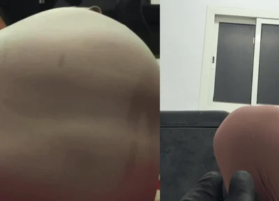 Verticalargument4tight Dress