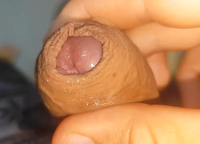 Its Source of Protein Is Already Dawning Like Rock