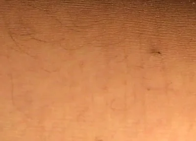 Hard Anal Fisting in Pantyhose