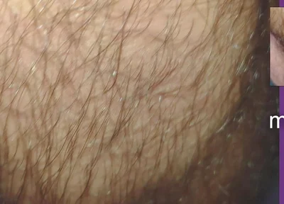 The Texture of the Clothes