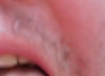 Camera Blunder in the Attempt at Facial Insemination